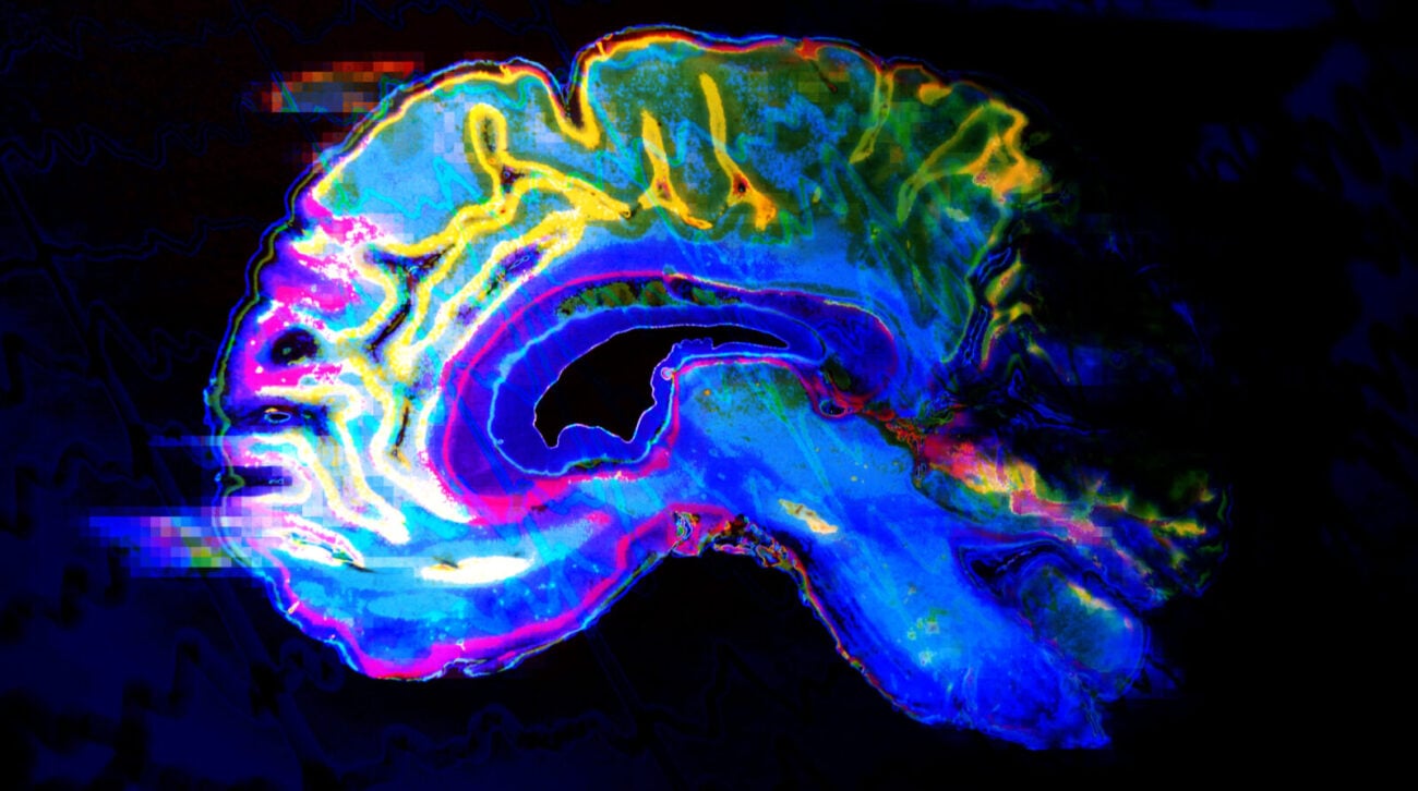 stylized colorful image of a brain scan