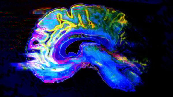 stylized colorful image of a brain scan