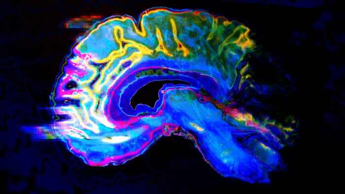 stylized colorful image of a brain scan